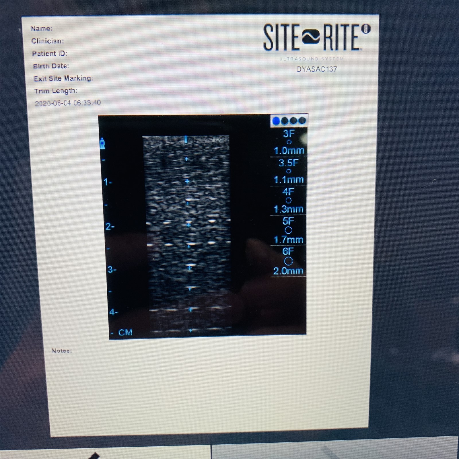 Bard Site Rite 8 Ultrasound System Ref 9770600Y (w/Eq. Rollstand, GCX Stor-Locx) - Image 8