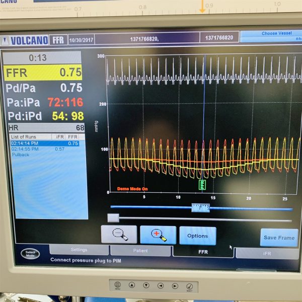 Philips Volcano s5 Ultrasound Image System 807300-001 IVUS & FFR w/s5 FFR Module - Image 10