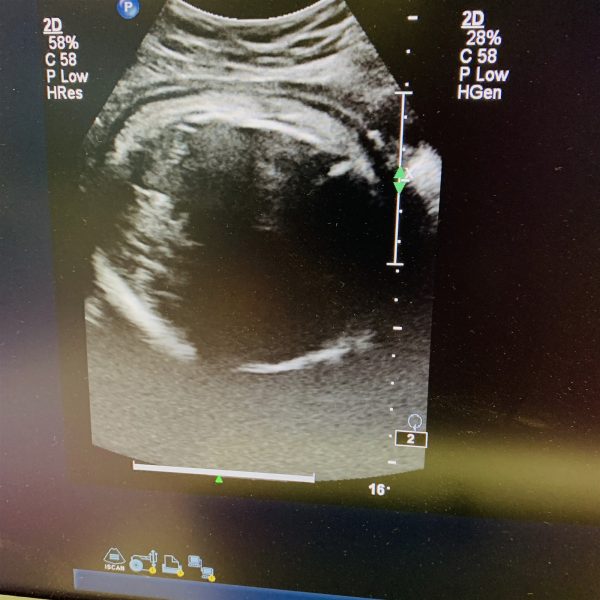 Philips iU22 Diagnostic Ultrasound Machine System Ref 8500-0064-02 w/C5-1 Probe - Image 10
